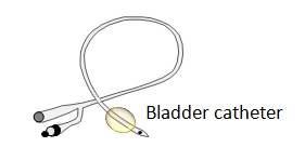 Bladder catheter